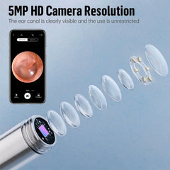 KERUI smart ear wax removal tool with 5MP HD camera, light, and endoscope otoscope for safe and precise ear cleaning