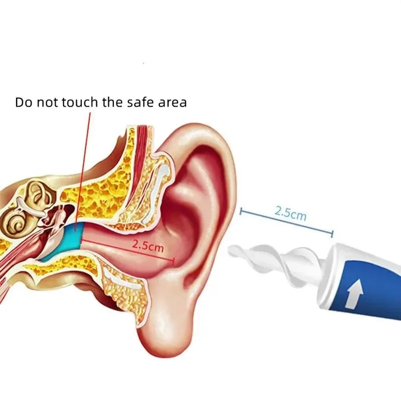 Ear Wax Remover Tool