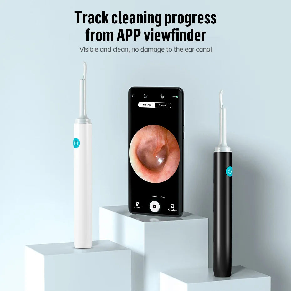 KERUI smart ear wax removal tool with 5MP HD camera, light, and endoscope otoscope for safe and precise ear cleaning