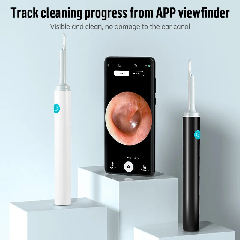 KERUI smart ear wax removal tool with 5MP HD camera, light, and endoscope otoscope for safe and precise ear cleaning